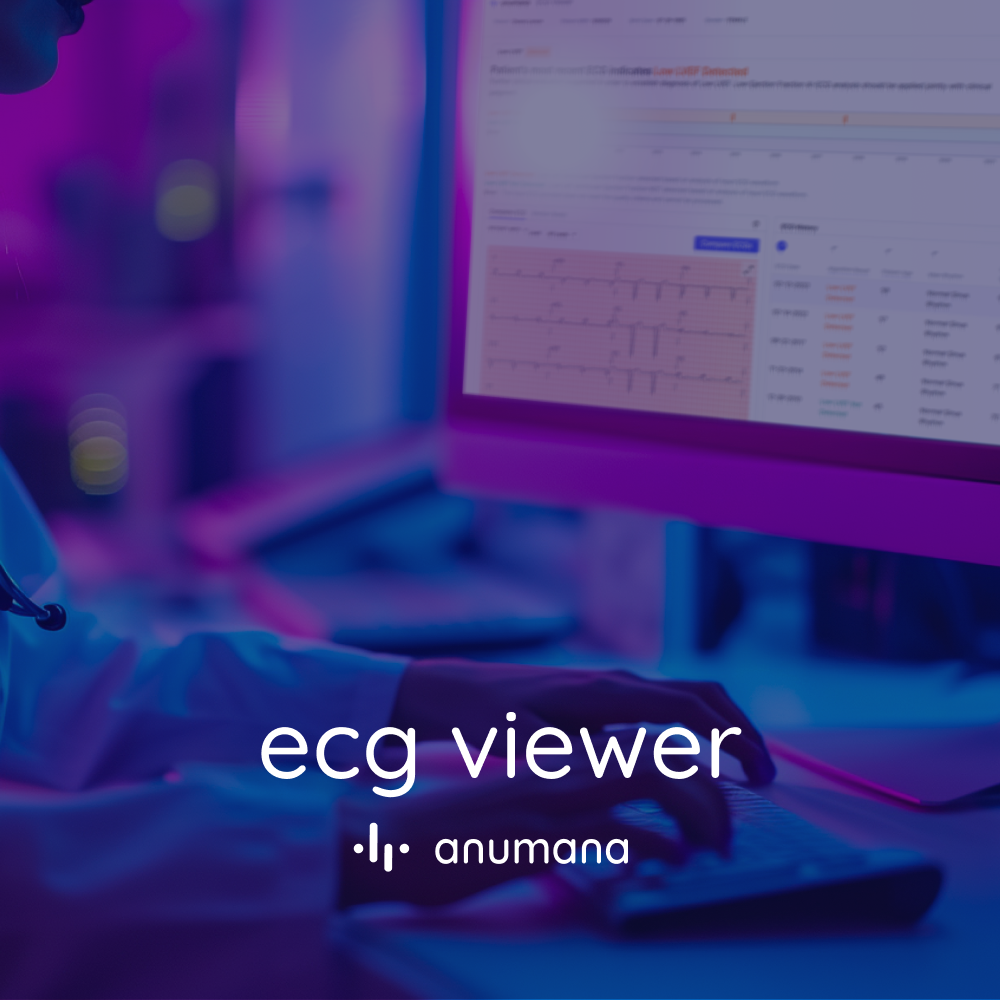 ECG Viewer